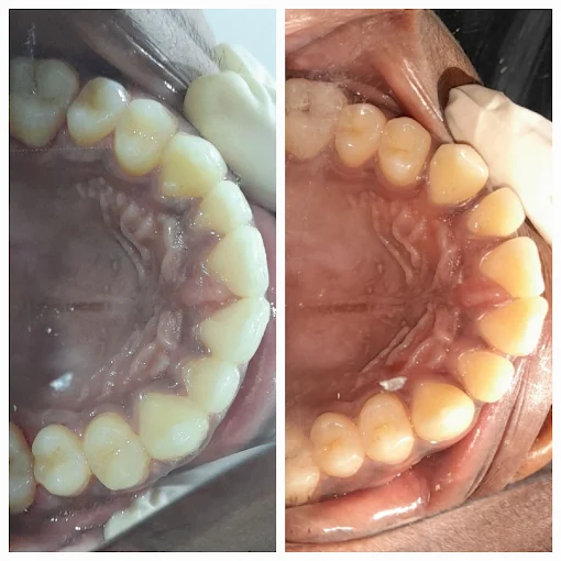Pooja Smile Care Dental Gallery Image 12